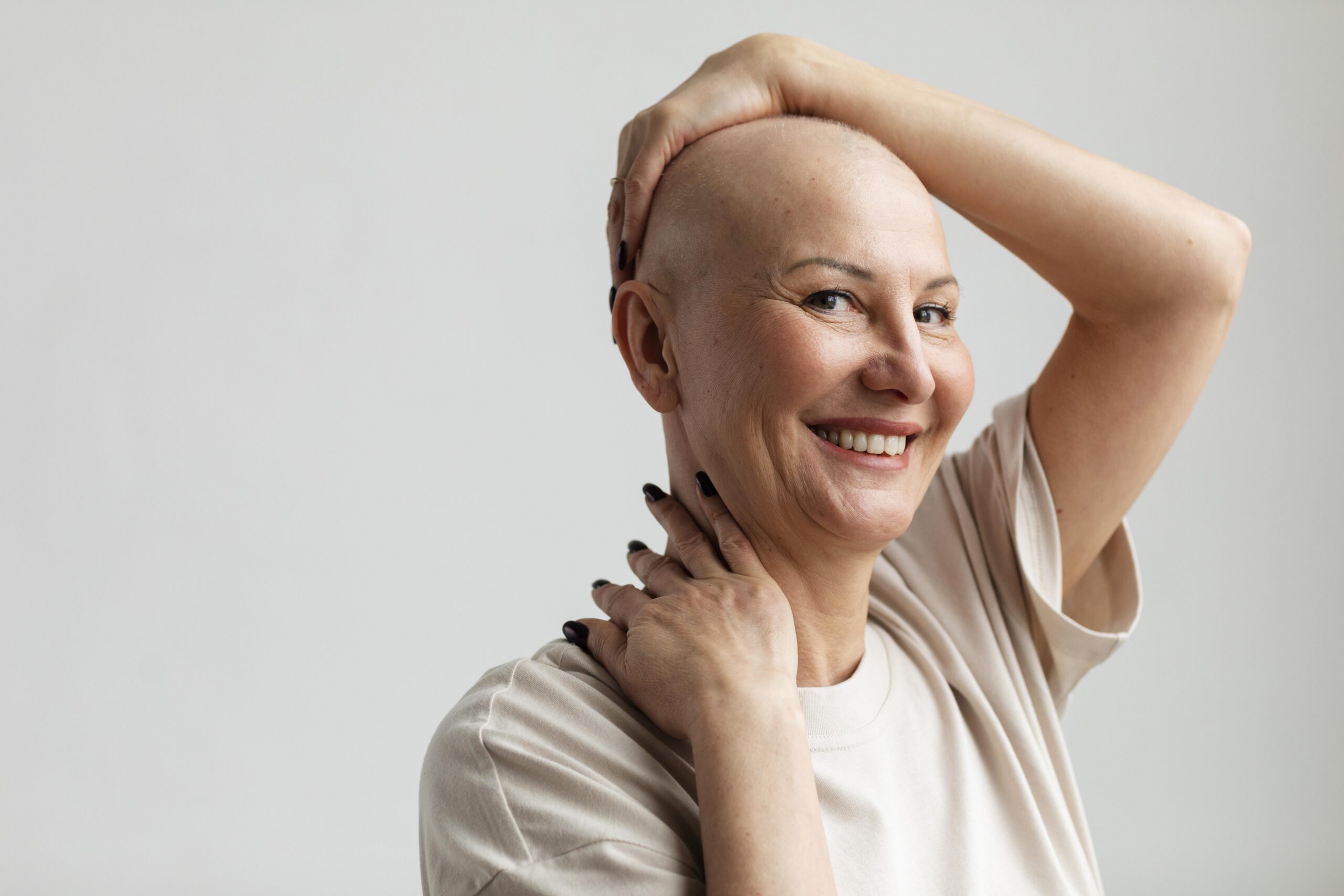 Femme au crâne rasé suite à une chimiothérapie, souriante et apaisée, illustrant les soins complémentaires en oncologie